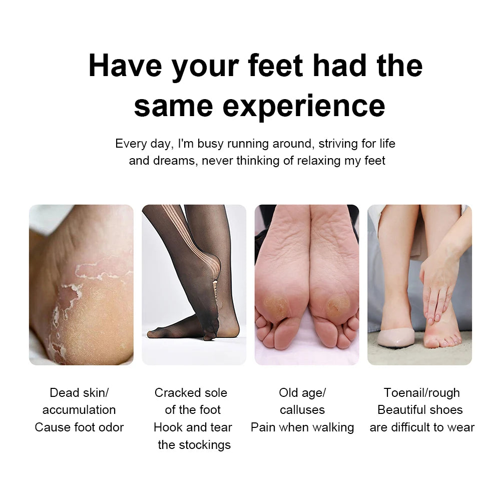 Electric Foot Callus Remover
