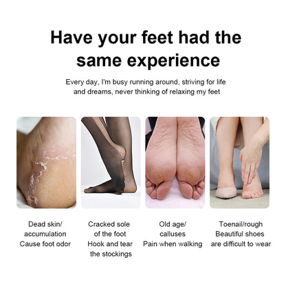 Electric Foot Callus Remover